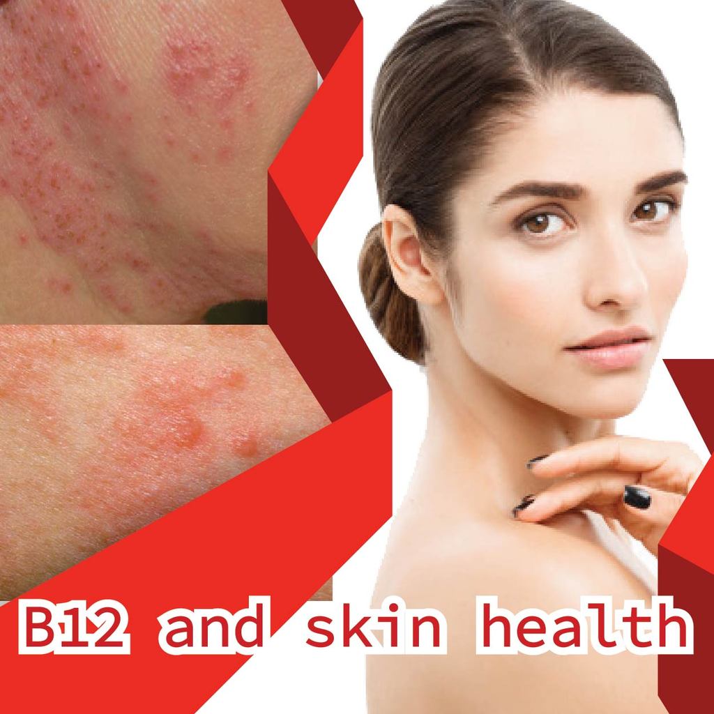 B12 and skin health